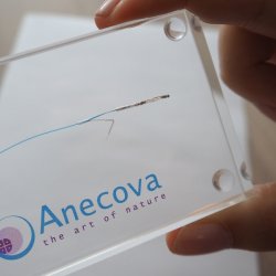 Szwajcarska firmę biotechnologiczna Anecova opracowała sztuczną metodę zapłodnienia, ale bliższą do naturalnej niż in vitro (fot. mat. prasowe)