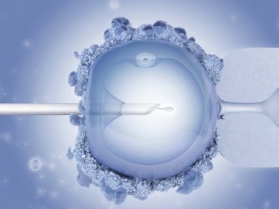 Rekrutacja do sosnowieckiego programu dofinansowań in vitro ruszy jeszcze w marcu (fot. foter.com)