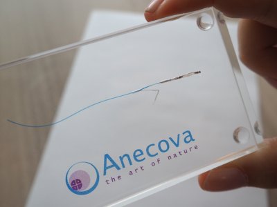 Szwajcarska firmę biotechnologiczna Anecova opracowała sztuczną metodę zapłodnienia, ale bliższą do naturalnej niż in vitro (fot. mat. prasowe)