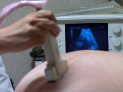 Gdy w ciąży pojawiają się problemy, to lekarz musi zadecydować o sposobach postępowania (fot.sxc.hu)